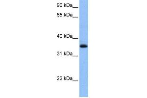WB Suggested Anti-CHN2 Antibody Titration: 0. (CHN2 antibody  (N-Term))