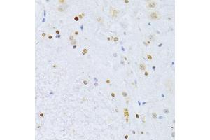 Immunohistochemistry of paraffin-embedded mouse spinal cord using ZEB2 antibody (ABIN5973336) at dilution of 1/100 (40x lens). (ZEB2 antibody)