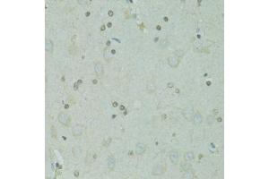 Immunohistochemistry of paraffin-embedded rat brain using GTF2H2C antibody  at dilution of 1:100 (40x lens). (GTF2H2C antibody  (AA 1-300))