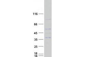 Ret Finger Protein-Like 1 (RFPL1) protein (Myc-DYKDDDDK Tag)