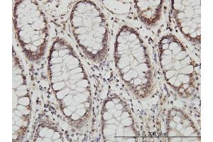 Immunoperoxidase of monoclonal antibody to PSMB8 on formalin-fixed paraffin-embedded human colon. (PSMB8 antibody  (AA 173-272))