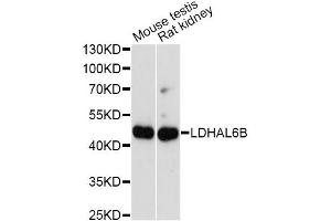 Western blot analysis of extracts of various cell lines, using LDHAL6B antibody. (LDHAL6B antibody)