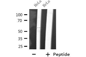 Western blot analysis of extracts from HeLa cells, using CYP2D6 antibody. (CYP2D6 antibody)