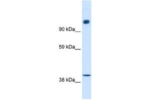 WB Suggested Anti-NCOR1 Antibody Titration:  0. (NCOR1 antibody  (N-Term))