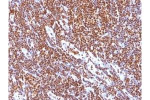 Formalin-fixed, paraffin-embedded human tonsil stained with SUMO-1 antibody (SUMO1/1188) (SUMO1 antibody)