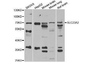 Western blot analysis of extracts of various cell lines, using SLC23A2 antibody. (SLC23A2 antibody)
