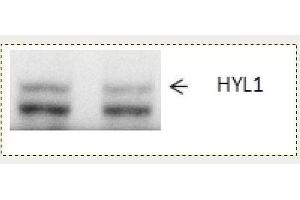 Western Blotting (WB) image for anti-Epoxide Hydrolase 1, Microsomal (Xenobiotic) (EPHX1) antibody (ABIN334544)