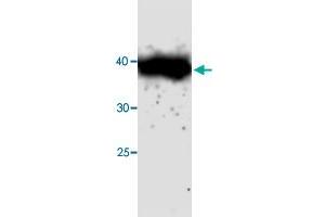 Western blot analysis in CTSH recombinant protein with CTSH monoclonal antibody, clone 69s45  at 1 : 1000 dilution. (Cathepsin H antibody)