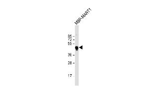 Anti-MBP tag Antibody at 1:2000 dilution + Recombinant MBP RT1 lysate Lysates/proteins at 20 μg per lane. (MBP Tag antibody)