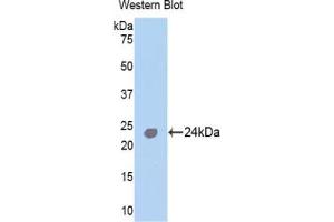 Detection of Recombinant TNNI1, Human using Polyclonal Antibody to Troponin I Type 1, Slow Skeletal (TNNI1) (TNNI1 antibody  (AA 142-187))