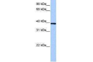 ZNF618 antibody  (N-Term)