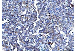 IHC analysis of Poliovirus Receptor/PVR using anti-Poliovirus Receptor/PVR antibody (ABIN7601072).