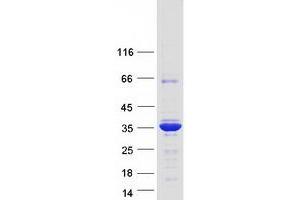Western Blotting (WB) image for Proenkephalin (PENK) (Transcript Variant 2) protein (Myc-DYKDDDDK Tag) (ABIN2729682)