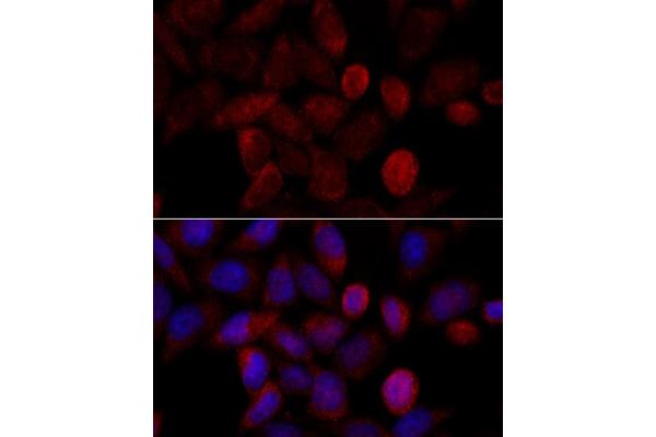 MLL/KMT2A antibody