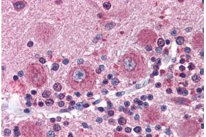 Human Brain, Cerebellum (formalin-fixed, paraffin-embedded) stained with DISC1 antibody ABIN337351 at 10 ug/ml followed by biotinylated goat anti-rabbit IgG secondary antibody ABIN481713, alkaline phosphatase-streptavidin and chromogen. (DISC1 antibody  (C-Term))