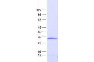 Validation with Western Blot (SPIC Protein (His tag))