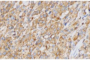 Immunohistochemistry (Paraffin-embedded Sections) (IHC (p)) image for anti-Plasminogen Activator Inhibitor 2 (SERPINB2) antibody (ABIN7234543)