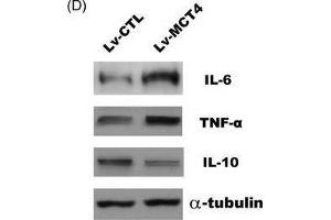 MCT4 modulates various inflammatory cytokines expression. (IL-10 antibody  (AA 19-178))