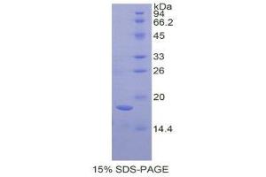 SDS-PAGE (SDS) image for Amelogenin, X-Linked (AMELX) (AA 49-187) protein (His tag) (ABIN1879767) (AMELX Protein (AA 49-187) (His tag))