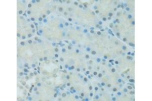 Immunohistochemistry of paraffin-embedded Rat kidney using CEBPA Polyclonal Antibody at dilution of 1:100 (40x lens). (CEBPA antibody)