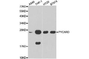 Western blot analysis of extracts of various cell lines, using PYCARD antibody. (PYCARD antibody  (AA 50-195))