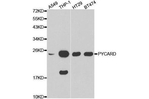 PYCARD Antikörper  (AA 50-195)