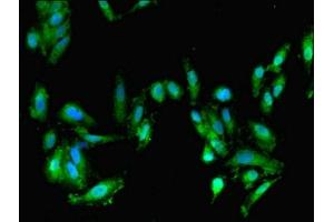 Immunofluorescent analysis of Hela cells using ABIN7152694 at dilution of 1:100 and Alexa Fluor 488-congugated AffiniPure Goat Anti-Rabbit IgG(H+L) (FARP2 antibody  (AA 261-550))