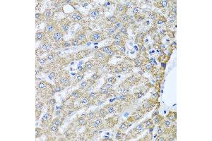Immunohistochemistry of paraffin-embedded human liver using TMEM189 antibody at dilution of 1:100 (40x lens). (TMEM189 antibody)