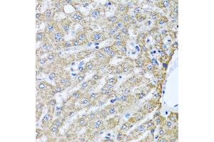 Immunohistochemistry of paraffin-embedded human liver using TMEM189 antibody at dilution of 1:100 (40x lens).