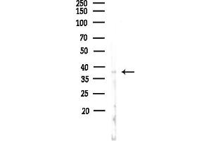 anti-Starch Binding Domain 1 (STBD1) (N-Term) antibody