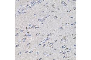 Immunohistochemistry of paraffin-embedded rat brain using TMC1 antibody (ABIN5996250) at dilution of 1/100 (40x lens). (TMC1 antibody)