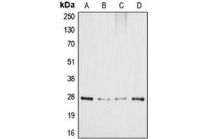 Western blot analysis of GADD153 expression in HeLa (A), MCF7 (B), SP2/0 (C), PC12 (D) whole cell lysates. (DDIT3 antibody  (Center))