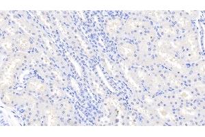 Detection of LOX1 in Bovine Kidney Tissue using Polyclonal Antibody to Lectin Like Oxidized Low Density Lipoprotein Receptor 1 (LOX1) (OLR1 antibody  (AA 57-270))