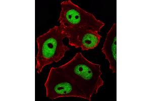Fluorescent image of MCF-7 cells stained with GATA3 Antibody (Center) (ABIN1944795 and ABIN2838499).