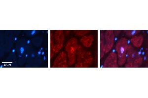 Rabbit Anti-BUB3 Antibody Catalog Number: ARP58599_P050 Formalin Fixed Paraffin Embedded Tissue: Human heart Tissue Observed Staining: Nucleus Primary Antibody Concentration: 1:100 Other Working Concentrations: N/A Secondary Antibody: Donkey anti-Rabbit-Cy3 Secondary Antibody Concentration: 1:200 Magnification: 20X Exposure Time: 0. (BUB3 antibody  (N-Term))