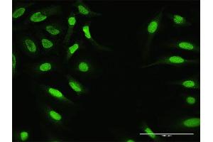 Immunofluorescence of purified MaxPab antibody to ZNF124 on HeLa cell. (ZNF124 antibody  (AA 1-289))