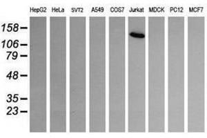 Image no. 2 for anti-Phosphoinositide-3-Kinase, Catalytic, gamma Polypeptide (PIK3CG) antibody (ABIN1500204)