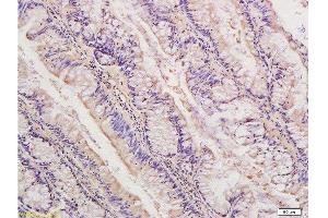 Immunohistochemistry (Paraffin-embedded Sections) (IHC (p)) image for anti-Insulin-Degrading Enzyme (IDE) (AA 491-590) antibody (ABIN723680)