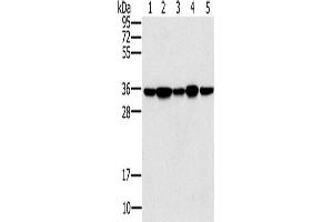 Western Blotting (WB) image for anti-Protein Phosphatase 1, Catalytic Subunit, gamma Isoform (PPP1CC) antibody (ABIN2822744)