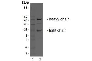 SDS-PAGE analysis of purified BBX-1H1 monoclonal antibody. (LGR4 antibody)