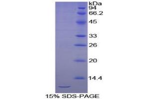 SDS-PAGE analysis of Chicken Cadherin, Epithelial Protein. (E-cadherin Protein)