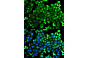 Immunofluorescence analysis of A549 cell using NCALD antibody. (NCALD antibody)
