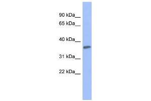 WB Suggested Anti-PRKCG Antibody Titration: 0. (PKC gamma antibody  (Middle Region))