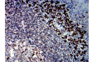 Immunohistochemistry (IHC) image for anti-Protein tyrosine Phosphatase, Receptor Type, C (PTPRC) (AA 378-577) antibody (ABIN7193646)