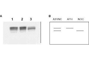 Image no. 1 for anti-Minichromosome Maintenance Complex Component 2 (MCM2) (AA 21-31) antibody (ABIN401335) (MCM2 antibody  (AA 21-31))