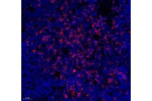 Immunofluorescence (Paraffin-embedded Sections) (IF (p)) image for anti-CD3 (CD3) antibody (ABIN7073386)