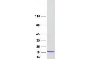 Validation with Western Blot