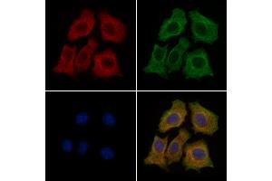 ABIN6260006 and ABIN6279136 staining HepG2 cells by IF/ICC.