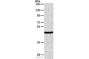 Western blot analysis of Mouse pancreas tissue, using ALKBH1 Polyclonal Antibody at dilution of 1:400