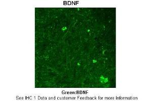Sample Type :  Rhesus macaque spinal cord  Primary Antibody Dilution :  1:300  Secondary Antibody :  Donkey anti Rabbit 488  Secondary Antibody Dilution :  1:500  Color/Signal Descriptions :  Green: BDNF  Gene Name :  BDNF  Submitted by :  Timur Mavlyutov, Ph. (BDNF antibody  (Middle Region))